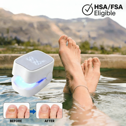 ✨New Arrival: Hotplex™ Nail Fungus Laser Device