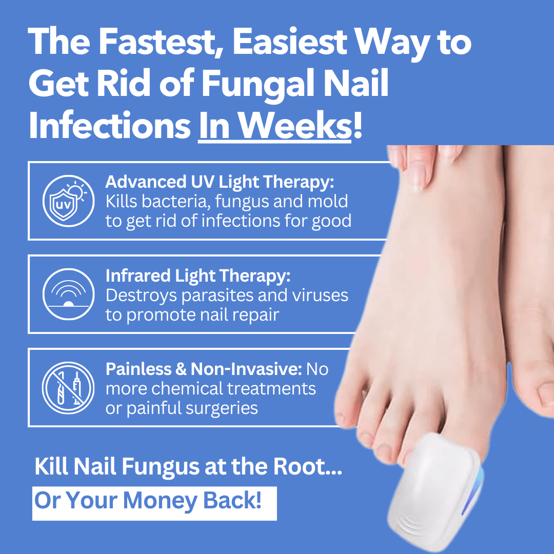 ✨New Arrival: Hotplex™ Nail Fungus Laser Device