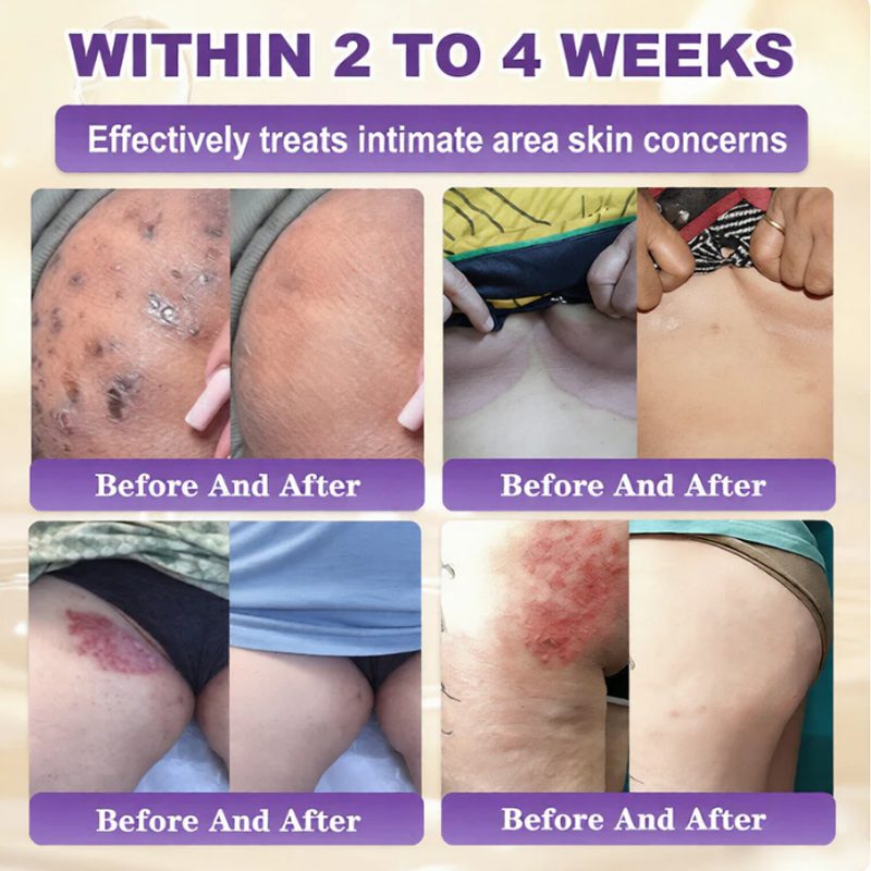 ✨Made and Shipped from USA ✨Owiwell® Biotin 10-in-1 Skin Restoration Cream 🍀