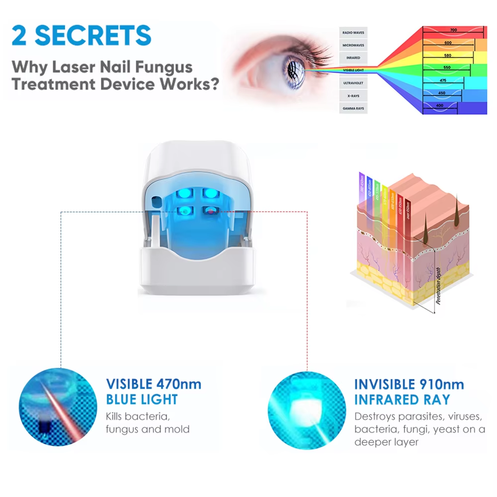 ✨New Arrival: Hotplex™ Nail Fungus Laser Device