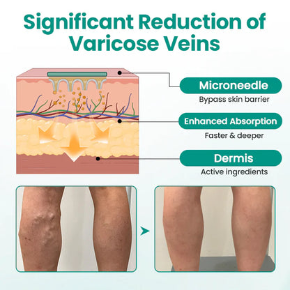 Hotplex® LegRenew Varicose Veins Patch