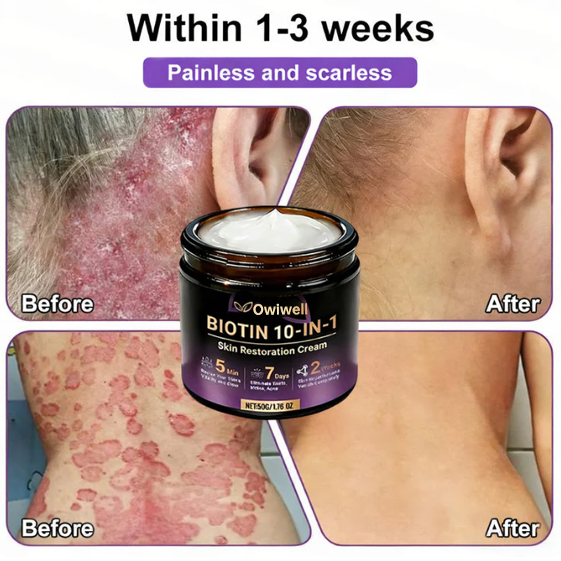 ✨Made and Shipped from USA ✨Owiwell® Biotin 10-in-1 Skin Restoration Cream 🍀