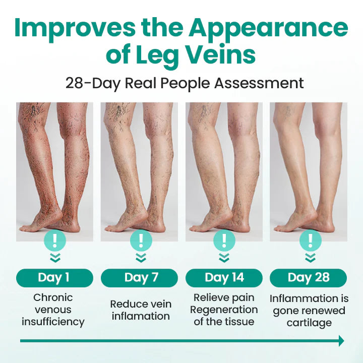 Hotplex® LegRenew Varicose Veins Patch