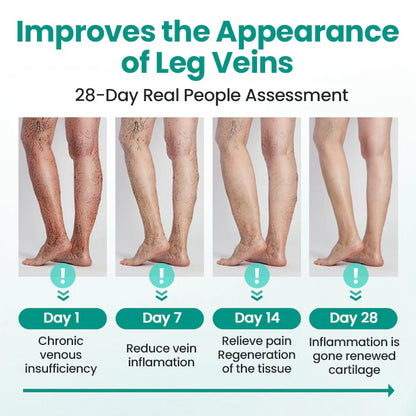 Hotplex® LegRenew Varicose Veins Patch