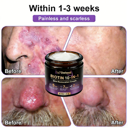 ✨Made and Shipped from USA ✨Owiwell® Biotin 10-in-1 Skin Restoration Cream 🍀