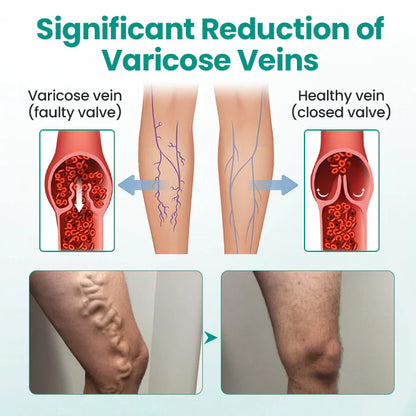 Hotplex® LegRenew Varicose Veins Patch